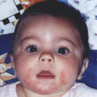 Poor Face Poor_Face