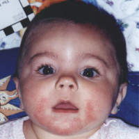 Poor_Face